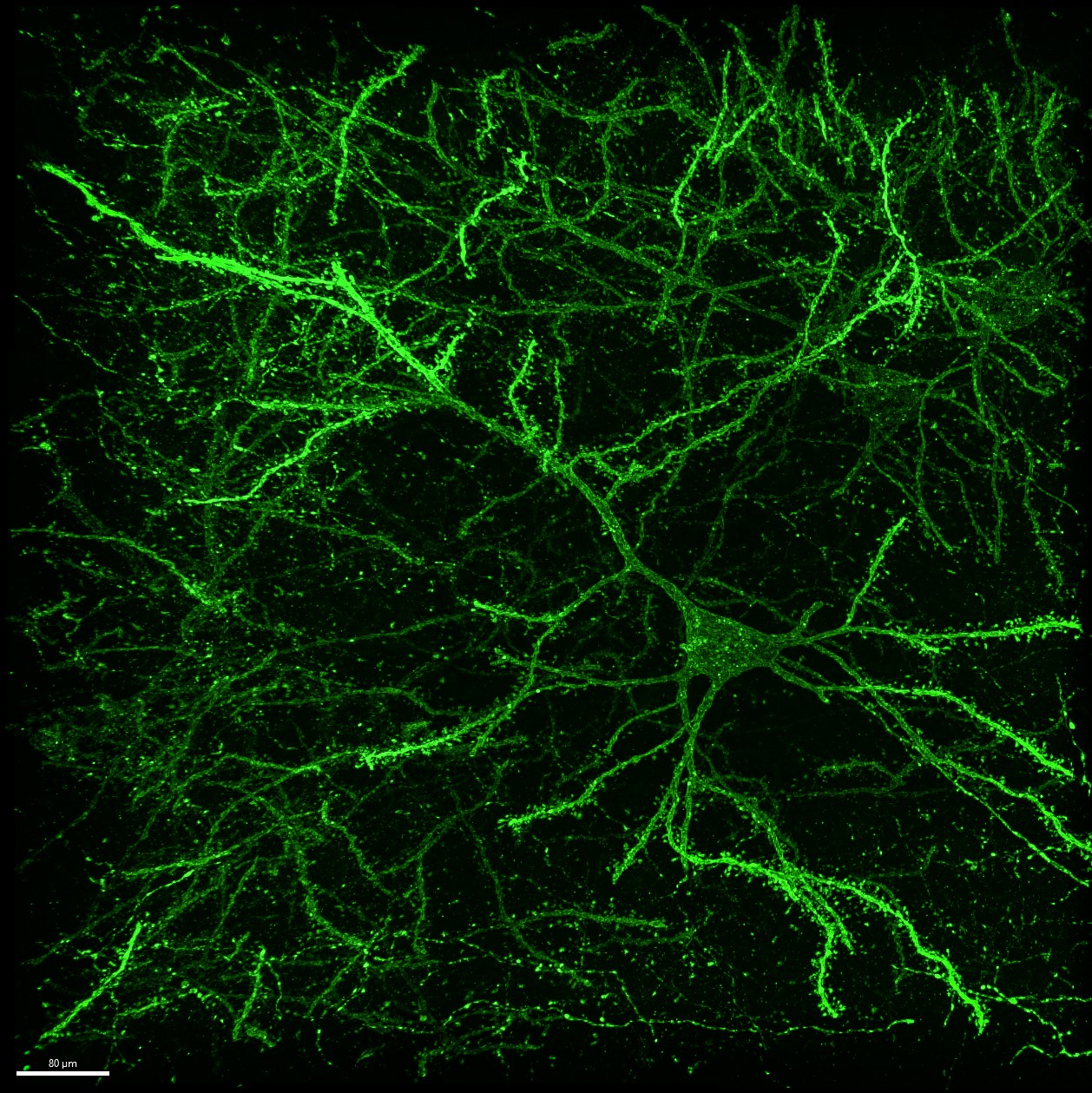 Branching cells in bright green on black